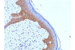 Immunohistochemical staining (Formalin-fixed paraffin-embedded sections) of human skin with DSG3 monoclonal antibody, clone 5G11 .