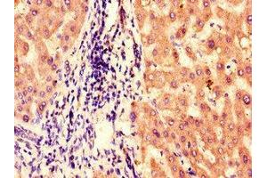 Immunohistochemistry (IHC) image for anti-Bardet-Biedl Syndrome 1 (BBS1) (AA 217-417) antibody (ABIN7145231)