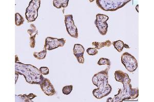 IHC analysis of ATP5F1B using anti-ATP5F1B antibody (ABIN7599866). (Atp5f1b (AA 123-529) 抗体)