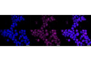 Immunocytochemical staining of Hela cells with PDX1 antibody (ABIN7799731), 1:1,000). (Recombinant PDX1 抗体)
