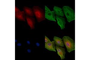 ABIN6258626 and ABIN6274597 staining  cells by IF/ICC.
