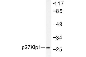 Image no. 1 for anti-Cyclin-Dependent Kinase Inhibitor 1B (p27, Kip1) (CDKN1B) antibody (ABIN271763) (CDKN1B 抗体)