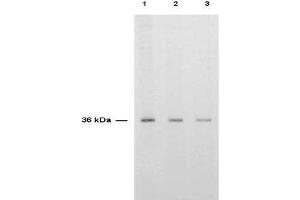 Anti-TS is shown to detect thymidylate synthase present in a HeLa cell extract. (TYMS 抗体)