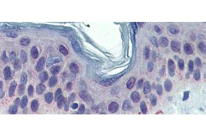 Immunohistochemistry (IHC) image for anti-Tyrosinase-Related Protein 1 (TYRP1) (Middle Region) antibody (ABIN2781815)
