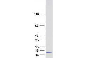 Western Blotting (WB) image for Adipogenesis Associated Mth938 Domain Containing (AAMDC) protein (Myc-DYKDDDDK Tag) (ABIN2715385)