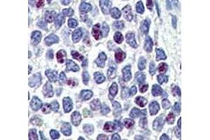 Immunohistochemistry (IHC) image for anti-Kruppel-Like Factor 4 (Gut) (KLF4) (AA 69-101) antibody (ABIN3031572)