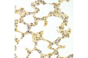 Immunohistochemistry of paraffin-embedded rat lung using IRF3 antibody (ABIN4904080) at dilution of 1:100 (40x lens). (IRF3 抗体)