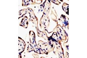 (ABIN6242136 and ABIN6578441) staining ERVK-7 in human placenta tissue sections by Immunohistochemistry (IHC-P - paraformaldehyde-fixed, paraffin-embedded sections). (ERVK-7 抗体  (AA 96-128))