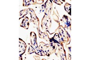 (ABIN6242136 and ABIN6578441) staining ERVK-7 in human placenta tissue sections by Immunohistochemistry (IHC-P - paraformaldehyde-fixed, paraffin-embedded sections).