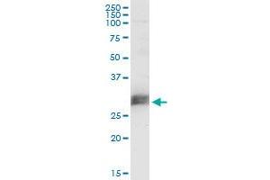 CD151 monoclonal antibody (M02), clone 1B2. (CD151 抗体  (AA 1-253))