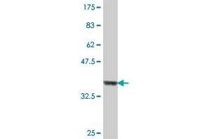 Western Blot detection against Immunogen (37 KDa) . (COPS3 抗体  (AA 324-422))