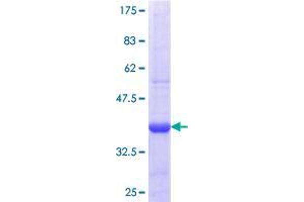SULF1 Protein (AA 780-871) (GST tag)