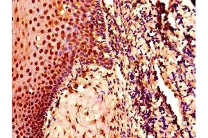 IHC image of ABIN7148865 diluted at 1:800 and staining in paraffin-embedded human tonsil tissue performed on a Leica BondTM system. (CDK2 抗体  (AA 1-298))