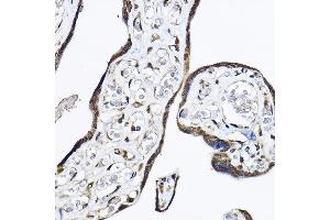 Immunohistochemistry of paraffin-embedded human placenta using P Rabbit pAb (ABIN6130631, ABIN6145213, ABIN6145214 and ABIN6214119) at dilution of 1:50 (40x lens). (PAP Associated Domain Containing 7 (PAPD7) (AA 303-542) 抗体)