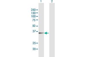 Western Blotting (WB) image for anti-Sulfotransferase Family 1B Member 1 (SULT1B1) (AA 1-296) antibody (ABIN949216)