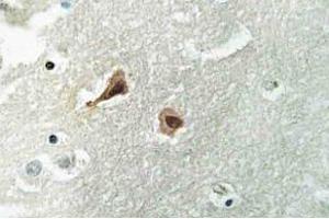 Immunohistochemistry (IHC) analyzes of VCP antibody in paraffin-embedded human brain tissue. (VCP 抗体)