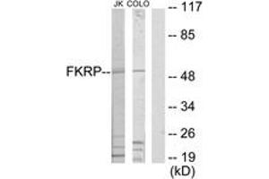Western blot analysis of extracts from Jurkat/COLO205 cells, using FKRP Antibody. (FKRP 抗体  (AA 1-50))