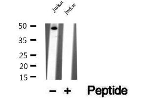 Western blot analysis of extracts of Jurkat cells, using WDR18 antibody. (WDR18 抗体  (Internal Region))
