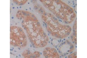 Used in DAB staining on fromalin fixed paraffin- embedded kidney tissue (RGS7 抗体  (AA 1-144))