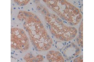 Used in DAB staining on fromalin fixed paraffin- embedded kidney tissue (RGS7 抗体  (AA 1-144))