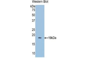 Western blot analysis of the recombinant protein. (Peroxiredoxin 5 抗体  (AA 1-162))