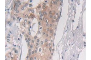 Immunohistochemistry (IHC) image for anti-Proteasome (Prosome, Macropain) Subunit, beta Type, 6 (PSMB6) (AA 2-239) antibody (ABIN7436234)