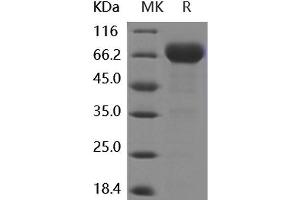 Western Blotting (WB) image for CD274 (PD-L1) (Active) protein (Fc Tag,ECD) (ABIN7194776)
