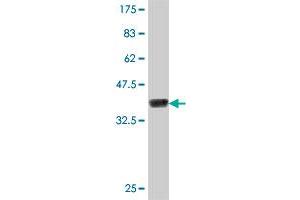 Western Blot detection against Immunogen (37. (TNPO2 抗体  (AA 201-300))