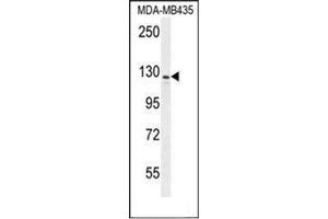 Western blot analysis of IBTK / BTKI Antibody (Center) in MDA-MB435 cell line lysates (35ug/lane).