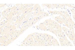 Detection of Lpa in Human Cardiac Muscle Tissue using Polyclonal Antibody to Lipoprotein, a (Lpa) (Lp(a) 抗体  (AA 1719-2038))