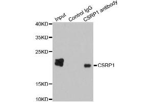 Immunoprecipitation analysis of 200ug extracts of HepG2 cells using 1ug CSRP1 antibody. (CSRP1 抗体)
