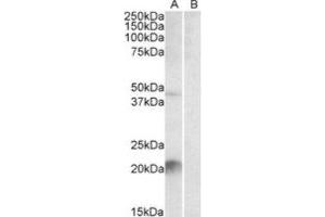 Western Blotting (WB) image for anti-Kallikrein 6 (KLK6) (C-Term) antibody (ABIN2464235) (Kallikrein 6 抗体  (C-Term))