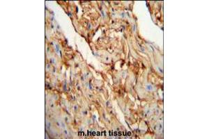 MYOZ1 Antibody immunohistochemistry analysis in formalin fixed and paraffin embedded mouse heart tissue followed by peroxidase conjugation of the secondary antibody and DAB staining. (Myozenin 1 抗体  (AA 40-69))