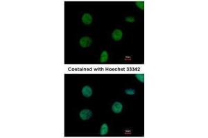 ICC/IF Image Immunofluorescence analysis of paraformaldehyde-fixed HeLa, using C1orf57, antibody at 1:500 dilution. (C1orf57 抗体  (C-Term))