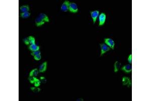 Immunofluorescence (IF) image for anti-Fc Fragment of IgE, Low Affinity II, Receptor For (CD23) (FCER2) (AA 48-321) antibody (ABIN7158533)