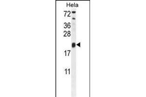 TRPC3 Antibody (N-term) 10175a western blot analysis in Hela cell line lysates (35 μg/lane). (TRAPPC3 抗体  (N-Term))