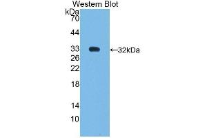 Detection of Recombinant SHP, Human using Polyclonal Antibody to Nuclear Receptor Subfamily 0,Group B,Member 2 (NR0B2) (NR0B2 抗体  (AA 1-257))