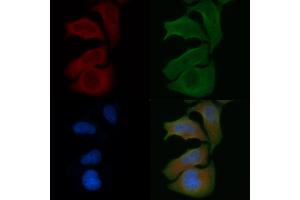 ABIN6257892 and ABIN6274756 staining Hela cells by IF/ICC.
