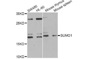 Western blot analysis of extracts of various cell lines, using SUMO1 Antibody (ABIN5971157) at 1/1000 dilution. (SUMO1 抗体)