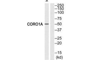 Western Blotting (WB) image for anti-Coronin, Actin Binding Protein, 1A (CORO1A) (Internal Region) antibody (ABIN1849308) (Coronin 1a 抗体  (Internal Region))