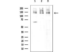 Western blot analysis of lysates from various samples, using  Antibody at 1/1000 dilution.