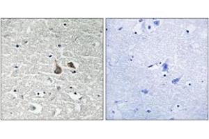 Immunohistochemistry analysis of paraffin-embedded human brain, using IRAK1 (Phospho-Ser376) Antibody. (IRAK1 抗体  (pSer376))