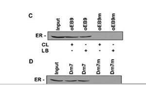 Activity Assay (AcA) image for Estrogen Receptor 1 (ESR1) (Transcript Variant 1) protein (Myc-DYKDDDDK Tag) (ABIN2720537)