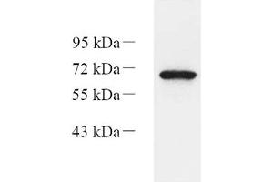 Western blot analysis of Eif2ak1 (ABIN7073875) at dilution of 1: 1000,Lane 1: HEK293 cell lysate (EIF2AK1 抗体)