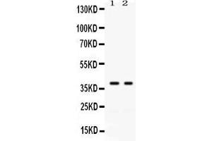 Western blot analysis of GAL4 expression in SW620 whole cell lysates ( Lane 1) and COLO320 whole cell lysates ( Lane 2). (GAL4 抗体  (C-Term))