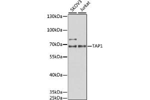 Western blot analysis of extracts of various cell lines, using T antibody (ABIN6131162, ABIN6148845, ABIN6148846 and ABIN6221804) at 1:1000 dilution. (TAP1 抗体  (AA 524-808))
