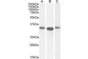 Western Blotting (WB) image for anti-Actin Related Protein 2/3 Complex, Subunit 2, 34kDa (ARPC2) (C-Term) antibody (ABIN184748)