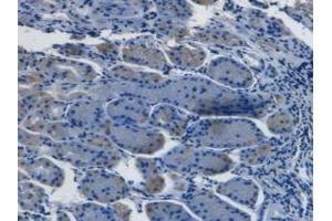 Detection of EDN1 in Human Stomach Tissue using Monoclonal Antibody to Endothelin 1 (EDN1) (Endothelin 1 抗体  (AA 53-90))