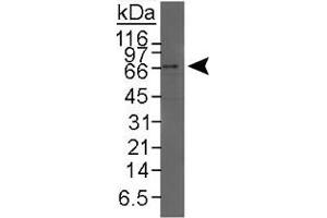 Western blot analysis of NR1H4 in HeLa nuclear extract using NR1H4 polyclonal antibody . (NR1H4 抗体  (C-Term))