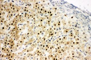 Anti-MTA1 antibody, IHC(F) IHC(F): Rat Ovary Tissue (MTA1 抗体  (C-Term))